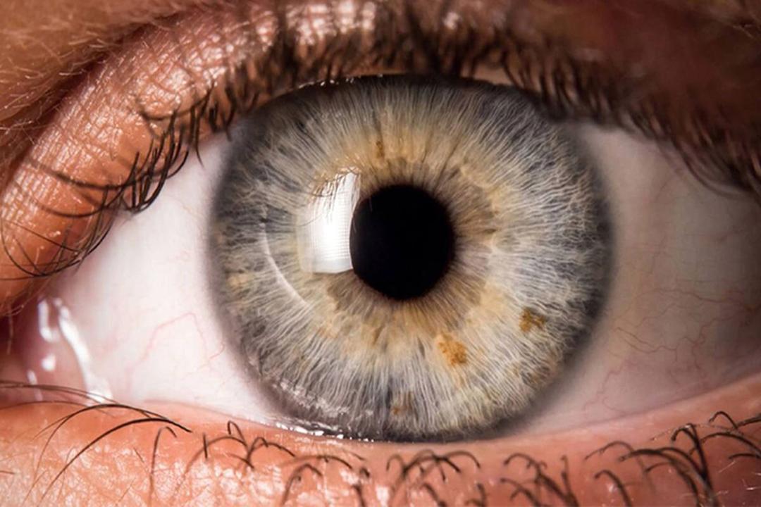 رنگ چشم در مورد سلامت ما چه می‌گوید؟